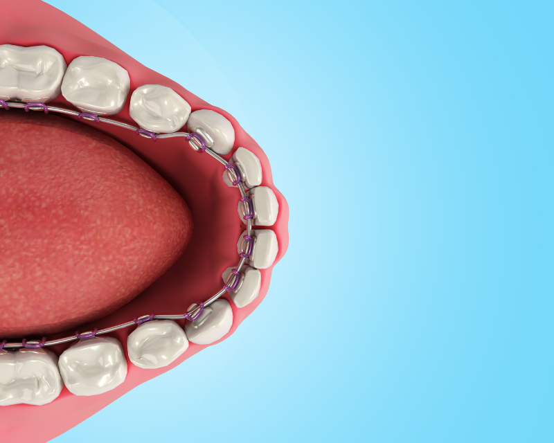 Wp Blog Size (800 X 640 Px) (1)